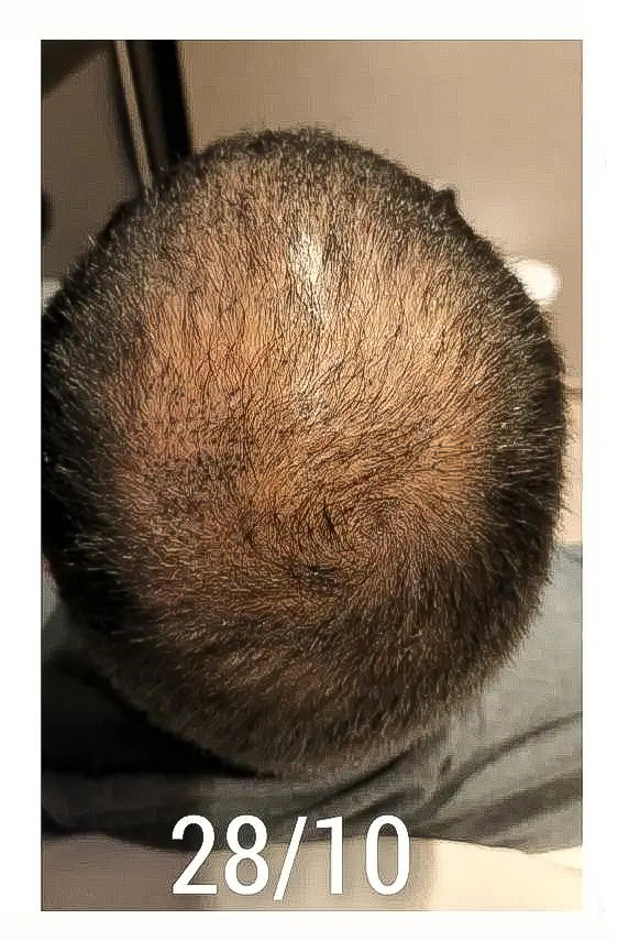 Left Image