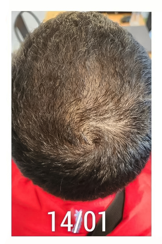 Right Image